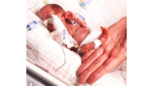 Prematre bebeklerin korkulu ryas: krlk